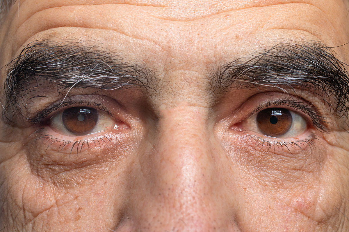 Diabetic Eye Screening West Coast Eye Institute Bakersfield, CA